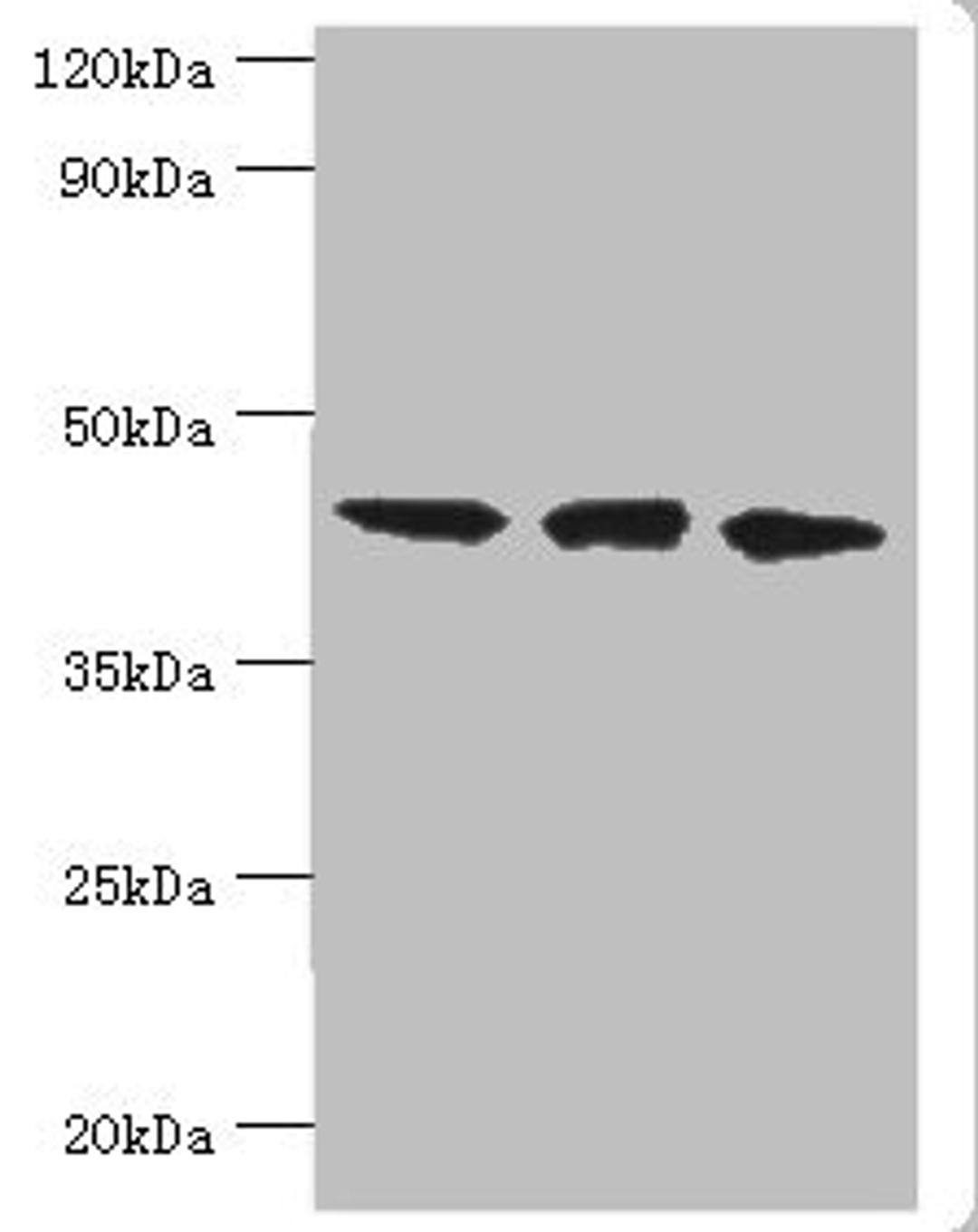 Western blot. All lanes: TAR DNA-binding protein 43 antibody at 8ug/ml. Lane 1: Hela whole cell lysate. Lane 2: Mouse spleen tissue. Lane: K562 whole cell lysate. Secondary. Goat polyclonal to rabbit IgG at 1/10000 dilution. Predicted band size: 45, 32 kDa. Observed band size: 45 kDa. 