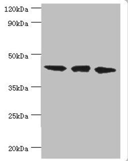 Western blot. All lanes: TAR DNA-binding protein 43 antibody at 8ug/ml. Lane 1: Hela whole cell lysate. Lane 2: Mouse spleen tissue. Lane: K562 whole cell lysate. Secondary. Goat polyclonal to rabbit IgG at 1/10000 dilution. Predicted band size: 45, 32 kDa. Observed band size: 45 kDa. 
