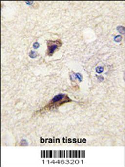 Formalin-fixed and paraffin-embedded human brain tissue reacted with NTF3 antibody , which was peroxidase-conjugated to the secondary antibody, followed by DAB staining.