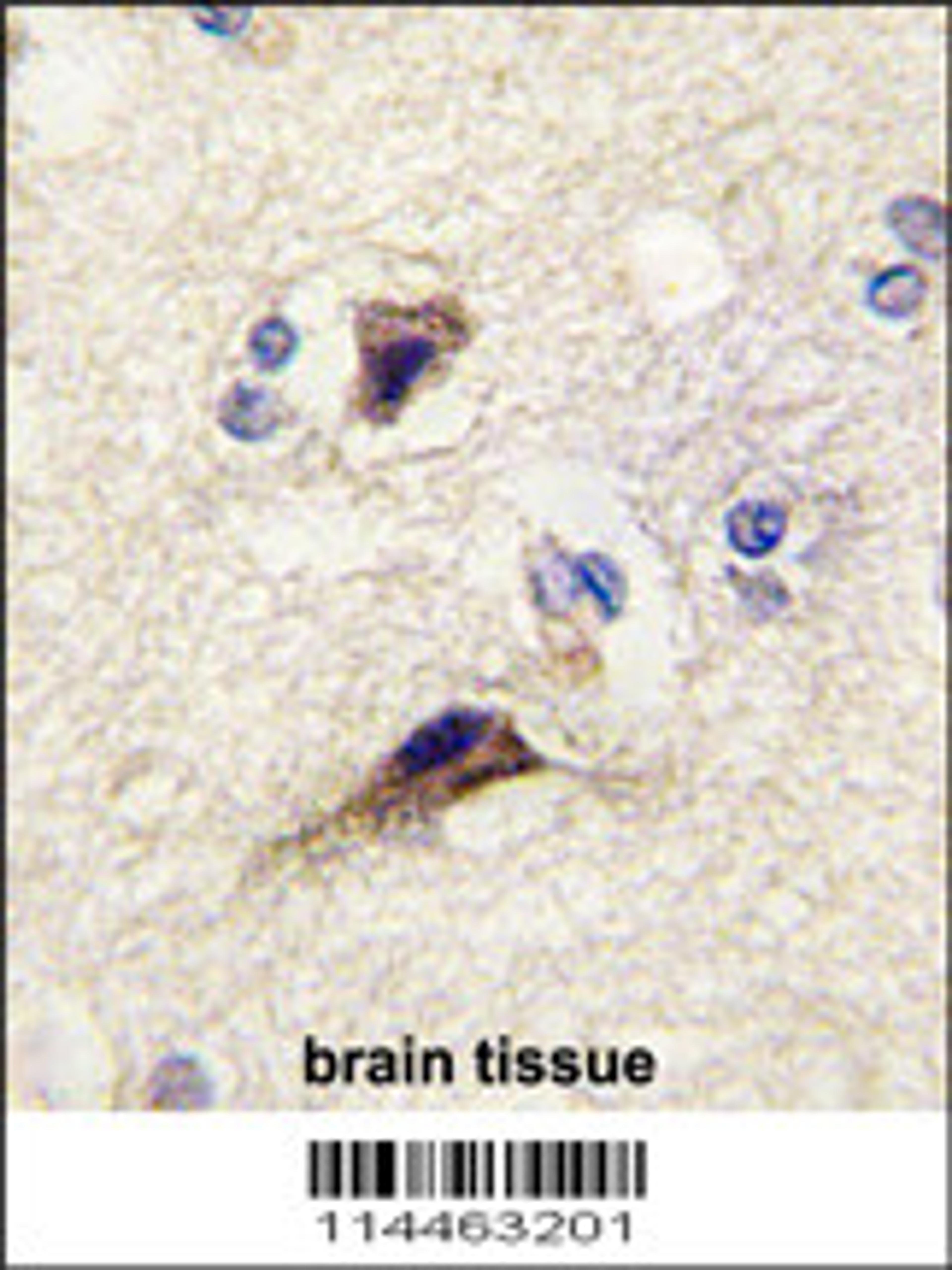 Formalin-fixed and paraffin-embedded human brain tissue reacted with NTF3 antibody , which was peroxidase-conjugated to the secondary antibody, followed by DAB staining.