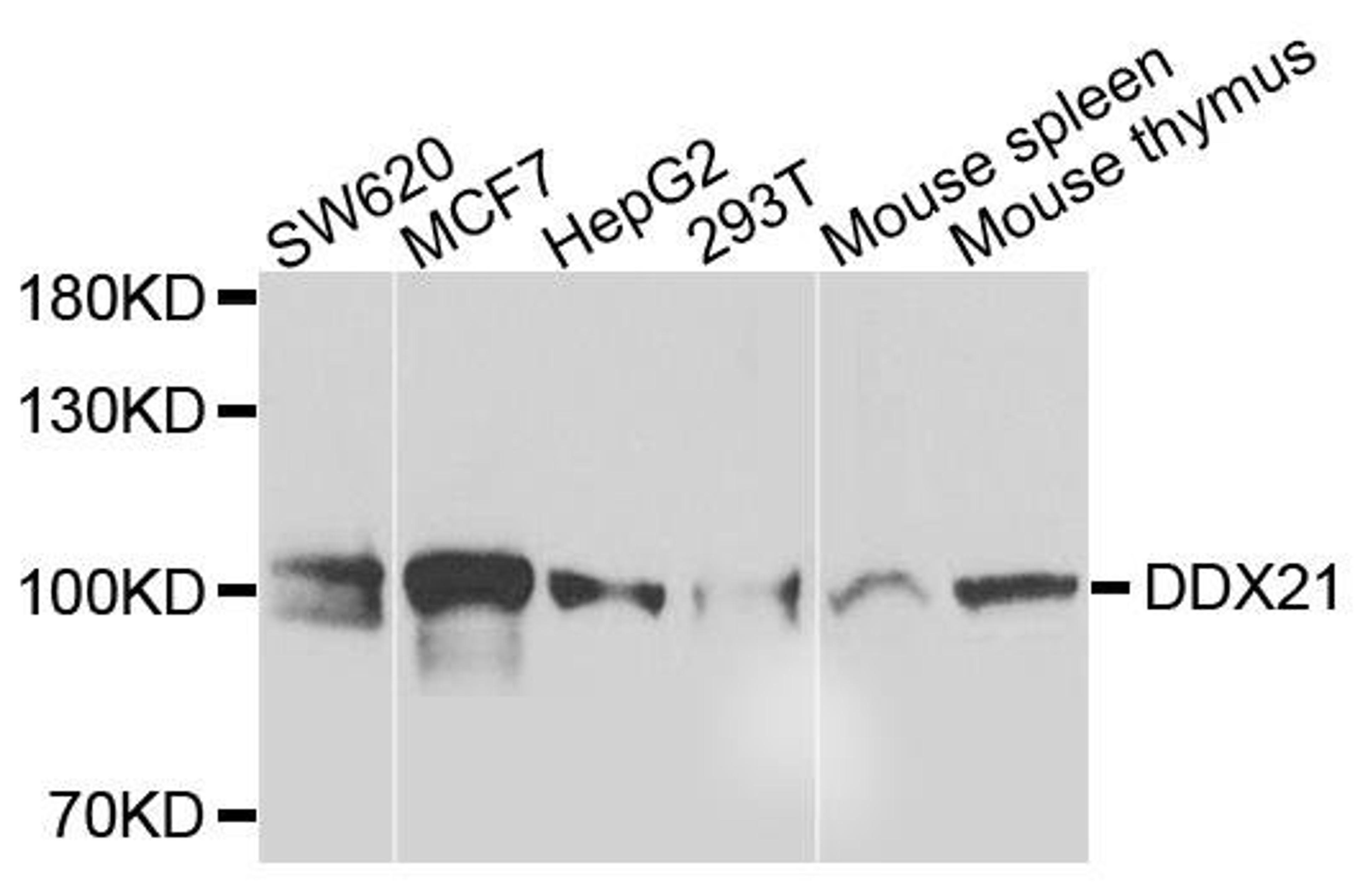 Western blot analysis of extracts of various cells using DDX21 antibody