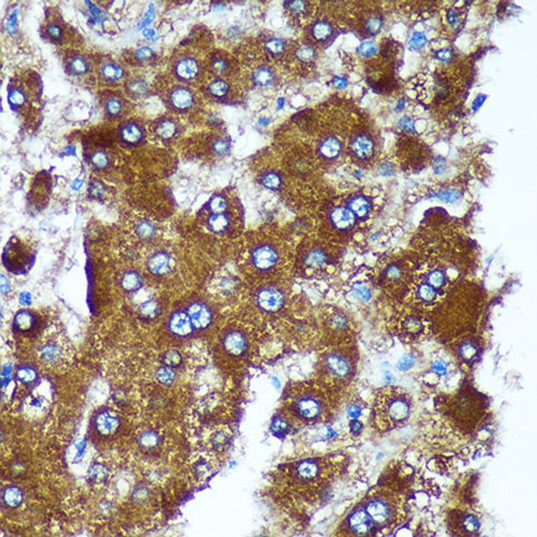 Immunohistochemistry  - PIGU Rabbit pAb (A18538)