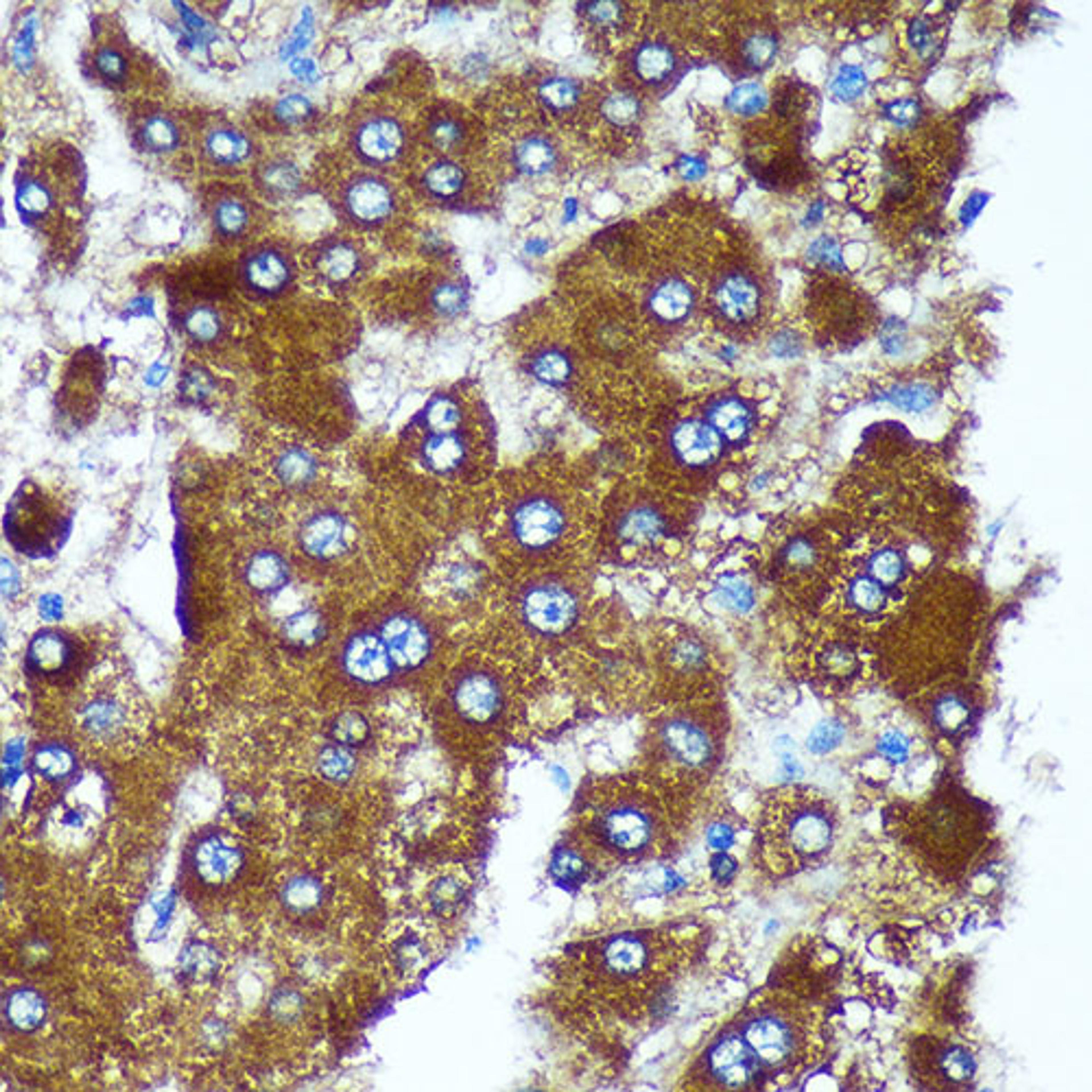 Immunohistochemistry - PIGU Rabbit pAb (A18538)