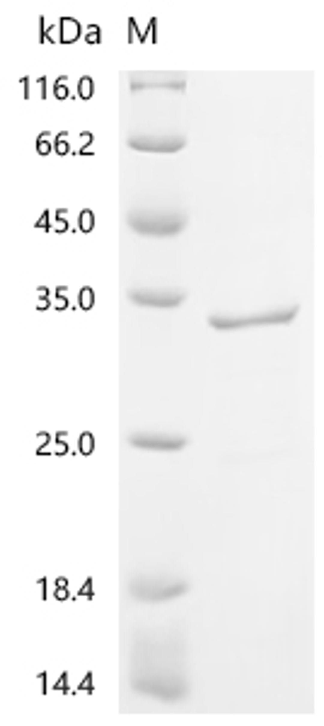 (Tris-Glycine gel) Discontinuous SDS-PAGE (reduced) with 5% enrichment gel and 15% separation gel.