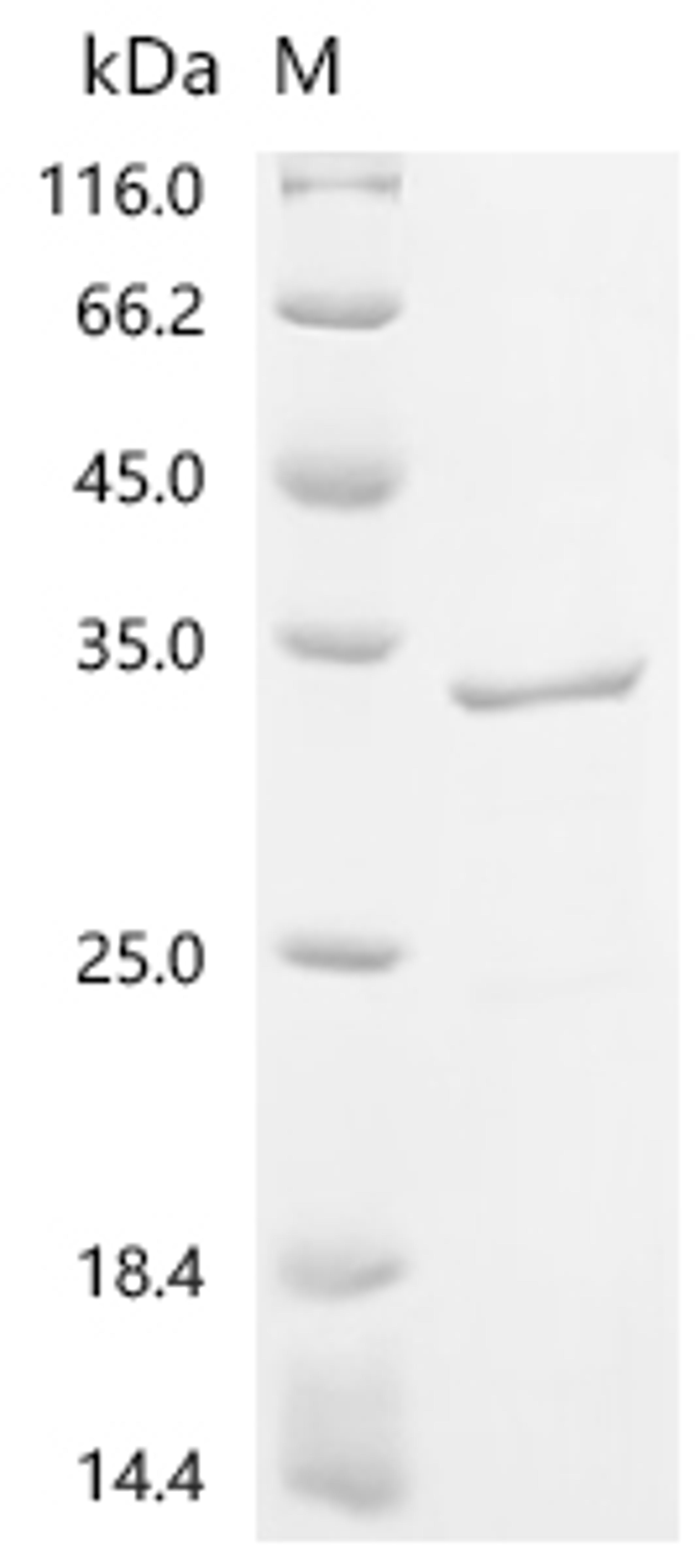 (Tris-Glycine gel) Discontinuous SDS-PAGE (reduced) with 5% enrichment gel and 15% separation gel.