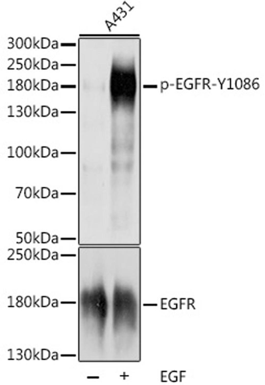 Western blot - Phospho-EGFR-Y1086 antibody (AP0820)