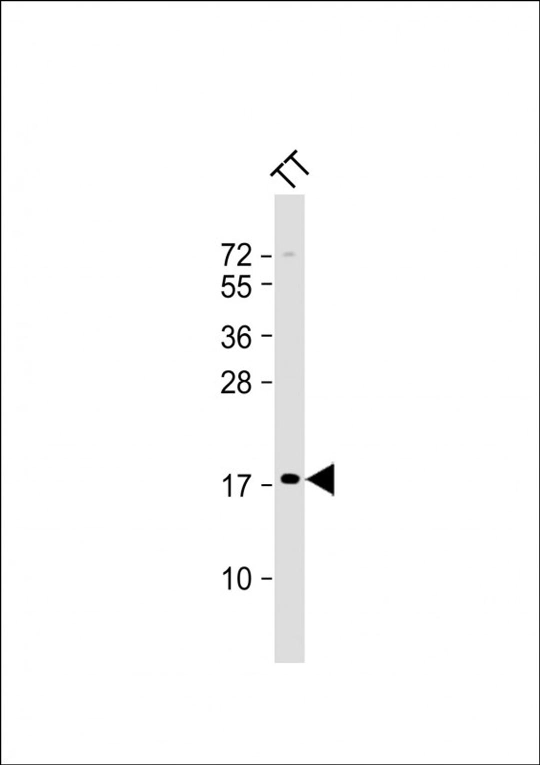 Western Blot at 1:2000 dilution + TT whole cell lysate Lysates/proteins at 20 ug per lane.