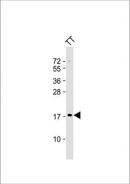 Western Blot at 1:2000 dilution + TT whole cell lysate Lysates/proteins at 20 ug per lane.