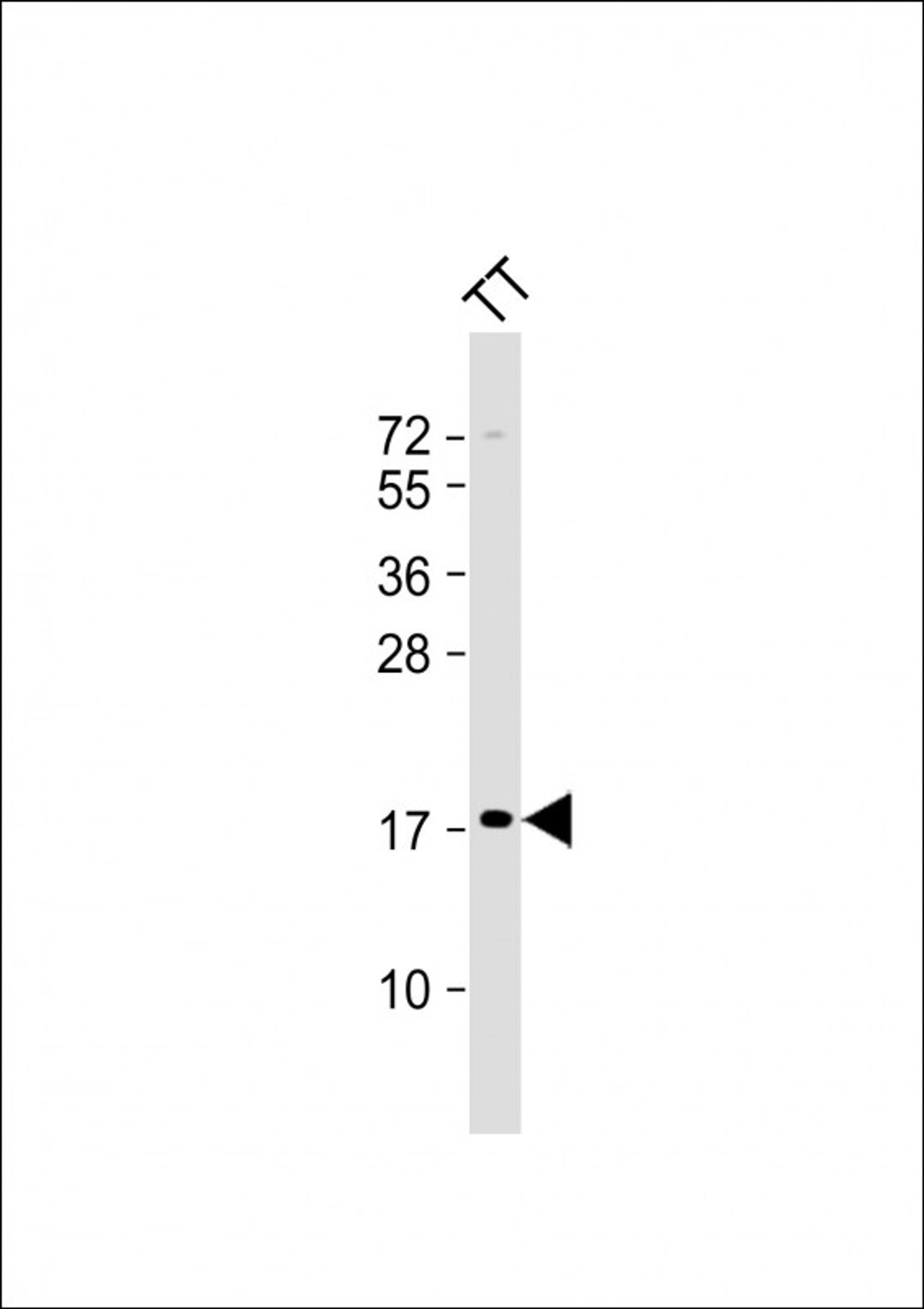 Western Blot at 1:2000 dilution + TT whole cell lysate Lysates/proteins at 20 ug per lane.