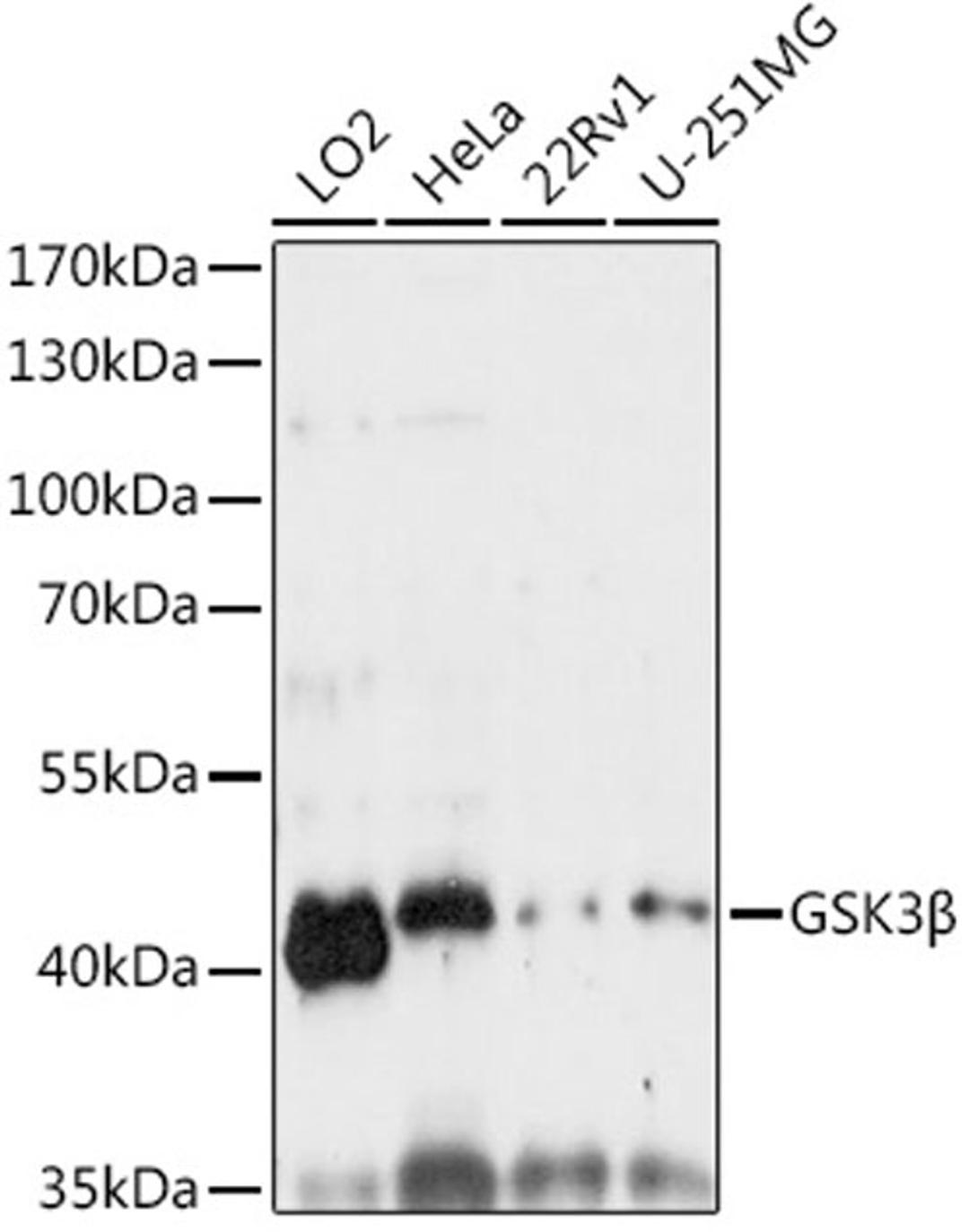 Western blot - GSK3ß antibody (A6164)