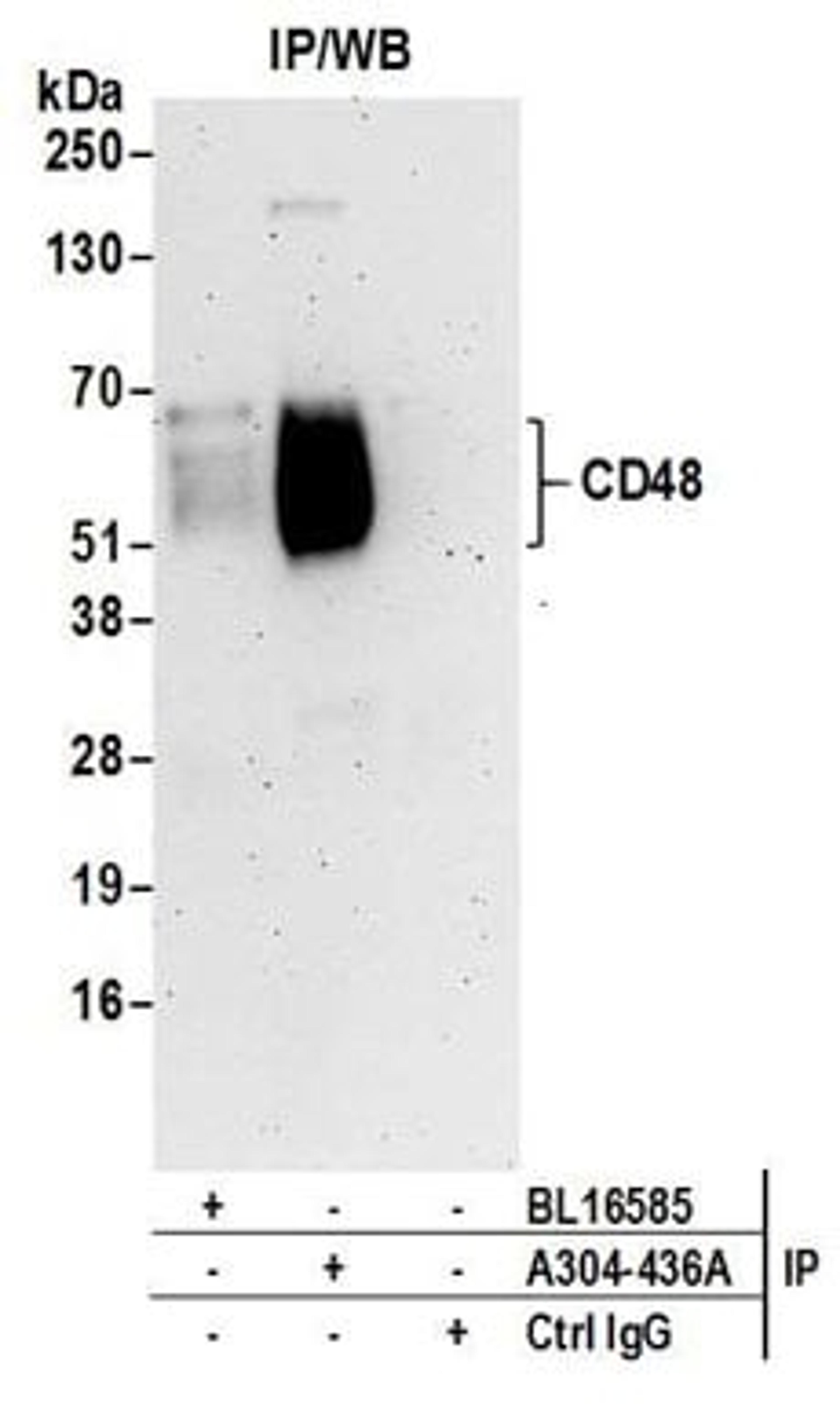 Detection of human CD48 by western blot of immunoprecipitates.