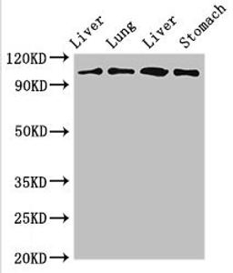 Western Blot. Positive WB detected in: Rat liver tissue, Rat lung tissue, Mouse liver tissue, Mouse stomach tissue. All lanes: MAP3K13 antibody at 3ug/ml. Secondary. Goat polyclonal to rabbit IgG at 1/50000 dilution. Predicted band size: 109, 18, 93, 86, 15 kDa. Observed band size: 109 kDa. 