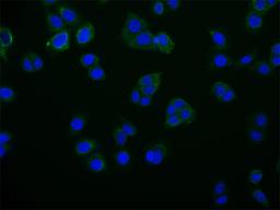 Immunofluorescence staining of PC-3 cell with CSB-RA284745A0HU at 1:50, counter-stained with DAPI. The cells were fixed in 4% formaldehyde and blocked in 10% normal Goat Serum. The cells were then incubated with the antibody overnight at 4°C. The secondary antibody was Alexa Fluor 516-congugated AffiniPure Goat Anti-Rabbit IgG(H+L).
