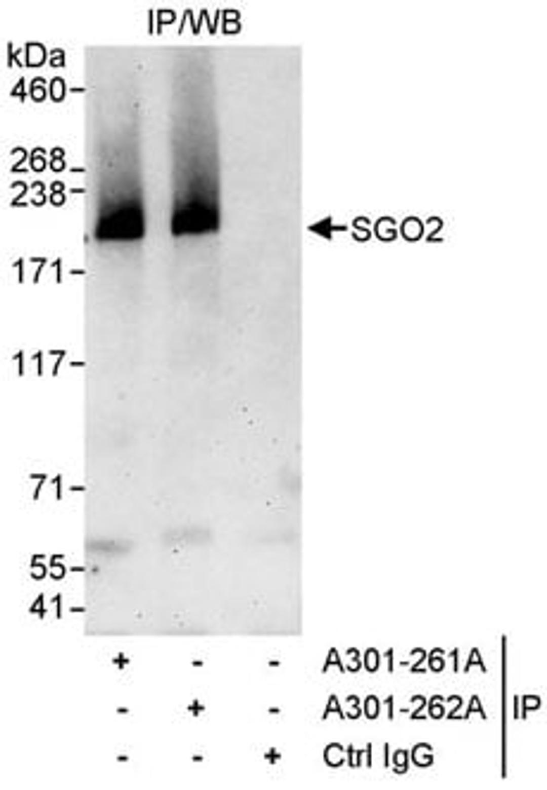 Detection of human SGO2 by western blot of immunoprecipitates.