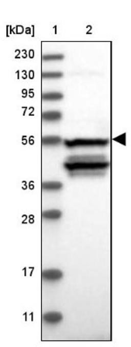 Western Blot: NOS1AP Antibody [NBP2-38151] - Lane 1: Marker [kDa] 230, 130, 95, 72, 56, 36, 28, 17, 11<br/>Lane 2: RT-4