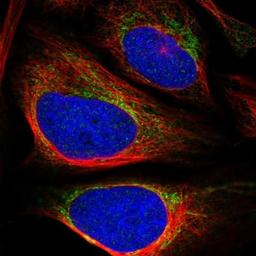 Immunocytochemistry/Immunofluorescence: ZNF467 Antibody [NBP1-92626] - Staining of human cell line U-2 OS shows positivity in mitochondria.