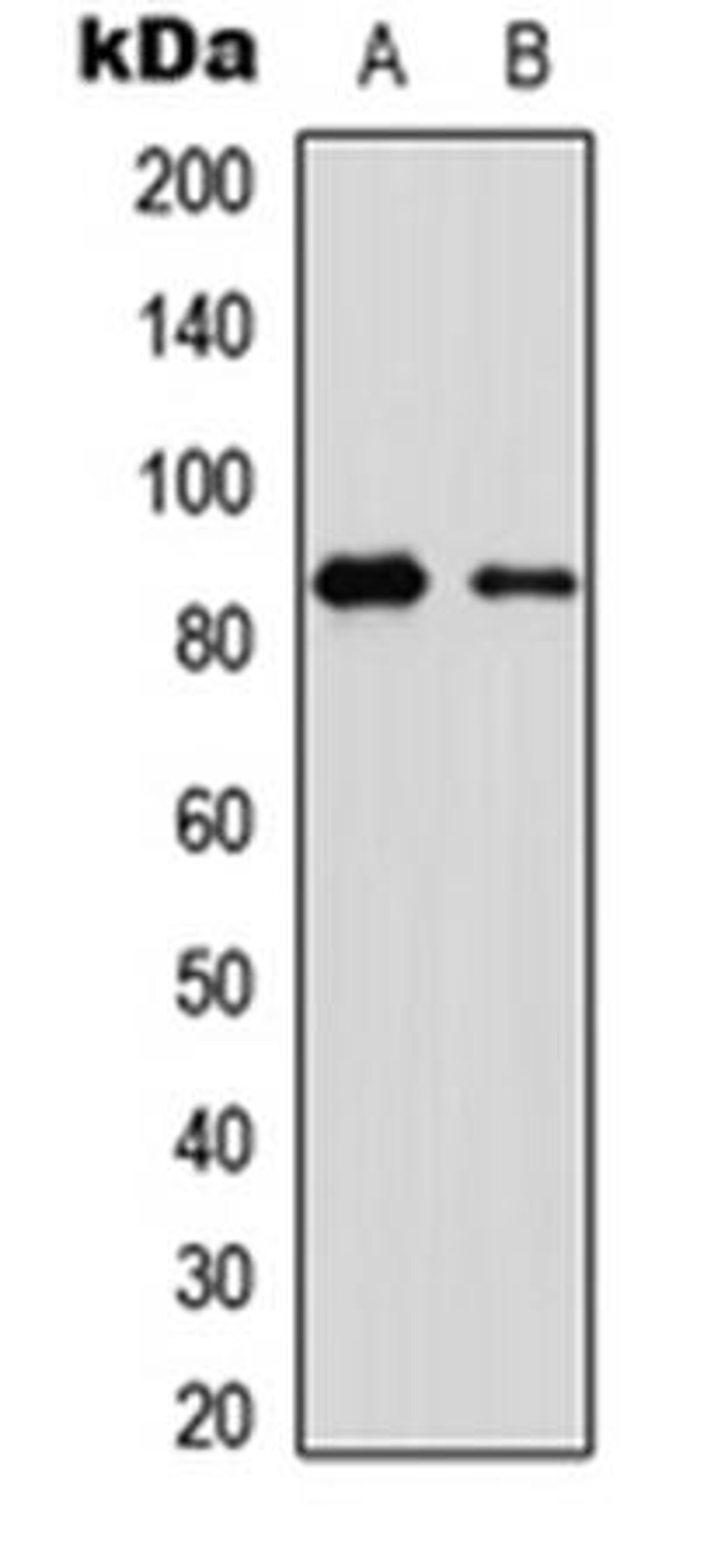 Western blot analysis of CEM (Lane1), human muscle (Lane2) whole cell using OLFML2B antibody