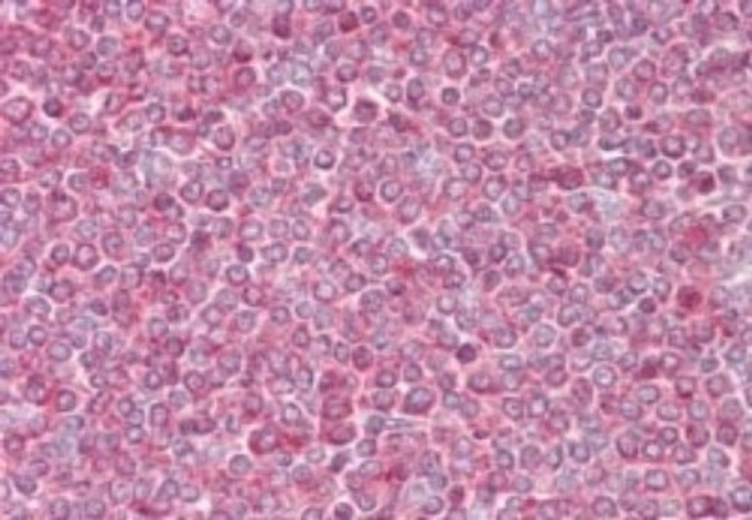 Immunohistochemistry-Paraffin: beta-Actin Antibody [NB100-56874] - analysisof human spleen using antibody at 10 ug/ml.