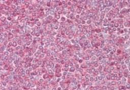 Immunohistochemistry-Paraffin: beta-Actin Antibody [NB100-56874] - analysisof human spleen using antibody at 10 ug/ml.