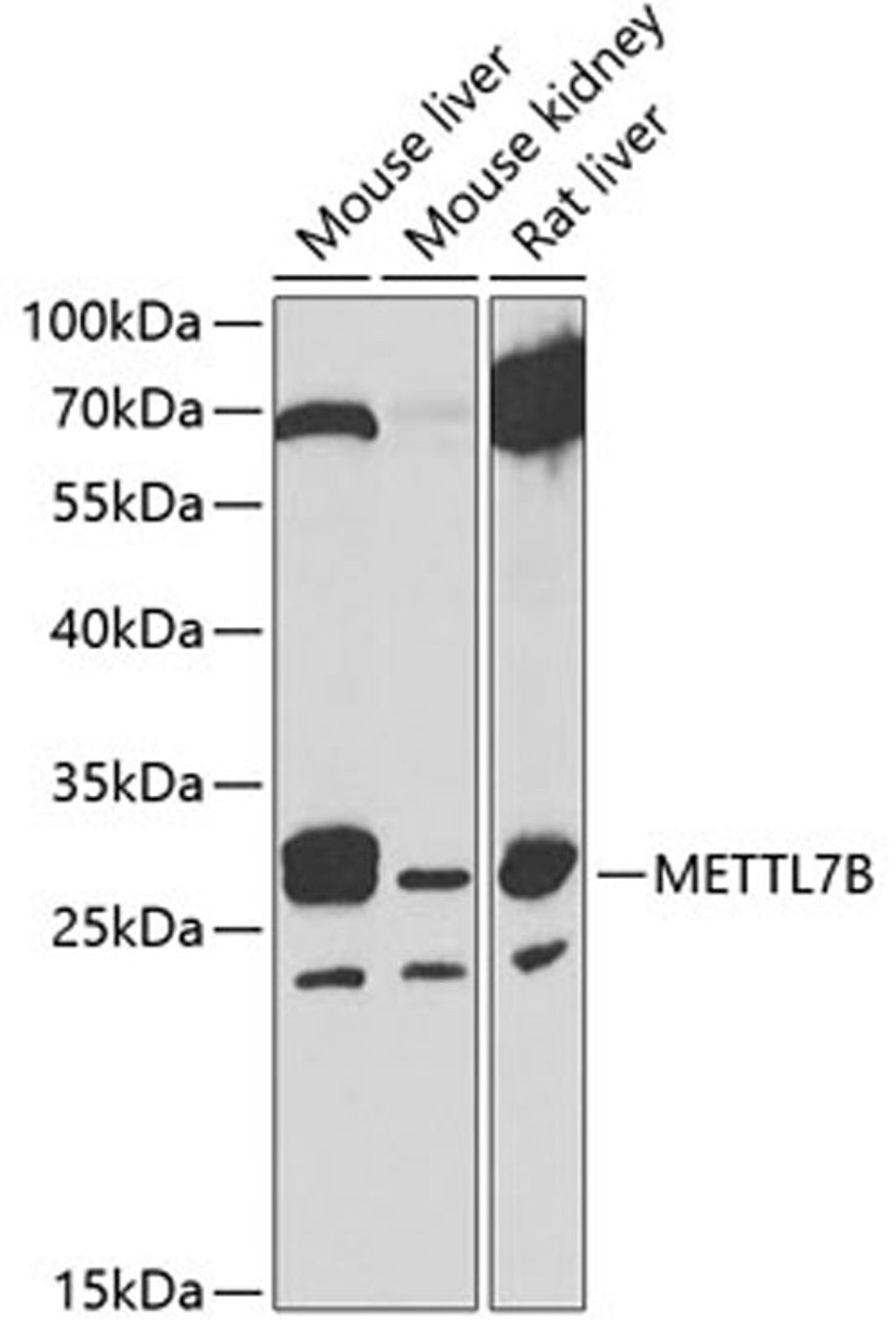 Western blot - METTL7B antibody (A7200)