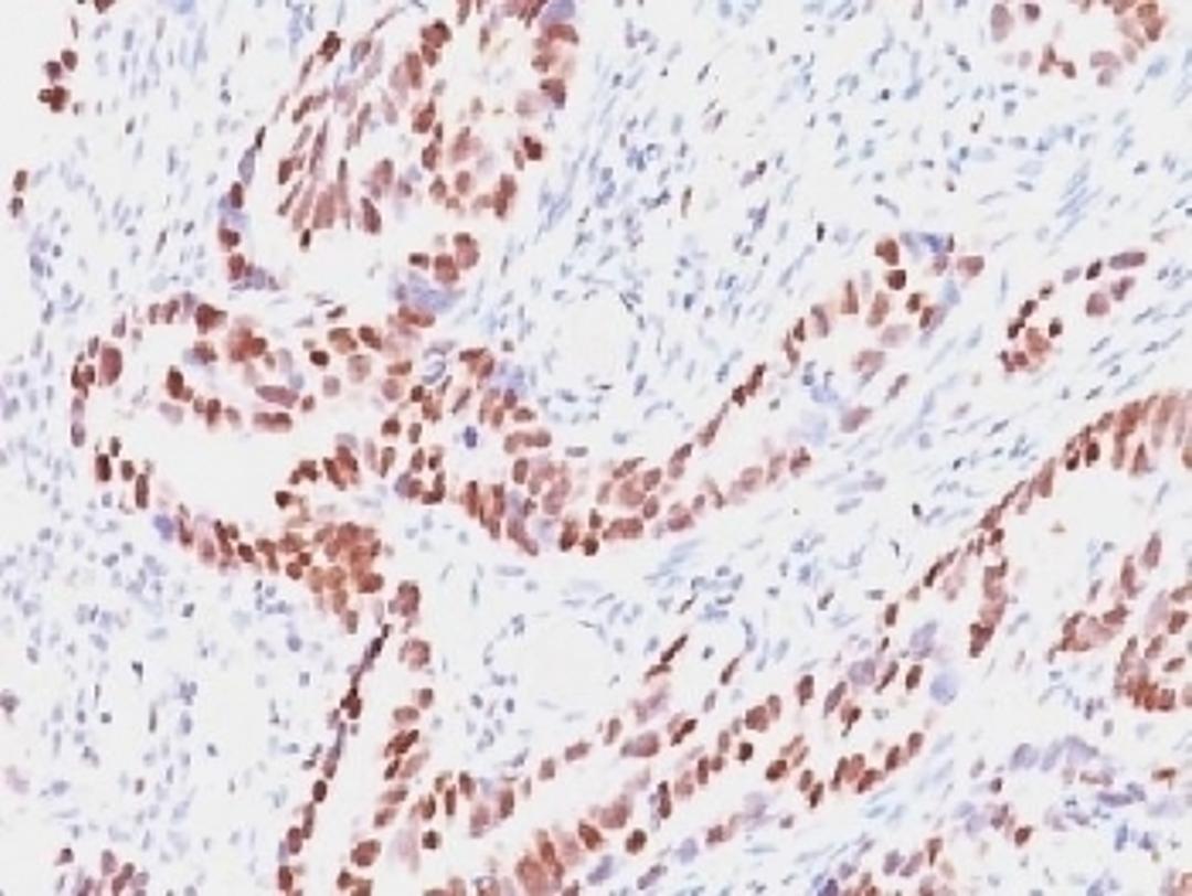 IHC testing of human colon with Retinoblastoma antibody (clone SPM353). Required HIER: boil tissue sections in 10mM citrate buffer, pH 6, for 10-20 min followed by cooling at RT for 20 min.