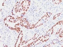 IHC testing of human colon with Retinoblastoma antibody (clone SPM353). Required HIER: boil tissue sections in 10mM citrate buffer, pH 6, for 10-20 min followed by cooling at RT for 20 min.