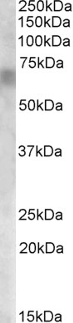 46-321 (0.1ug/ml) staining of Rat Retina lysate (35ug protein in RIPA buffer). Primary incubation was 1 hour. Detected by chemiluminescence.