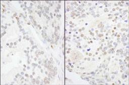 Detection of human and mouse ANKS3 by immunohistochemistry.