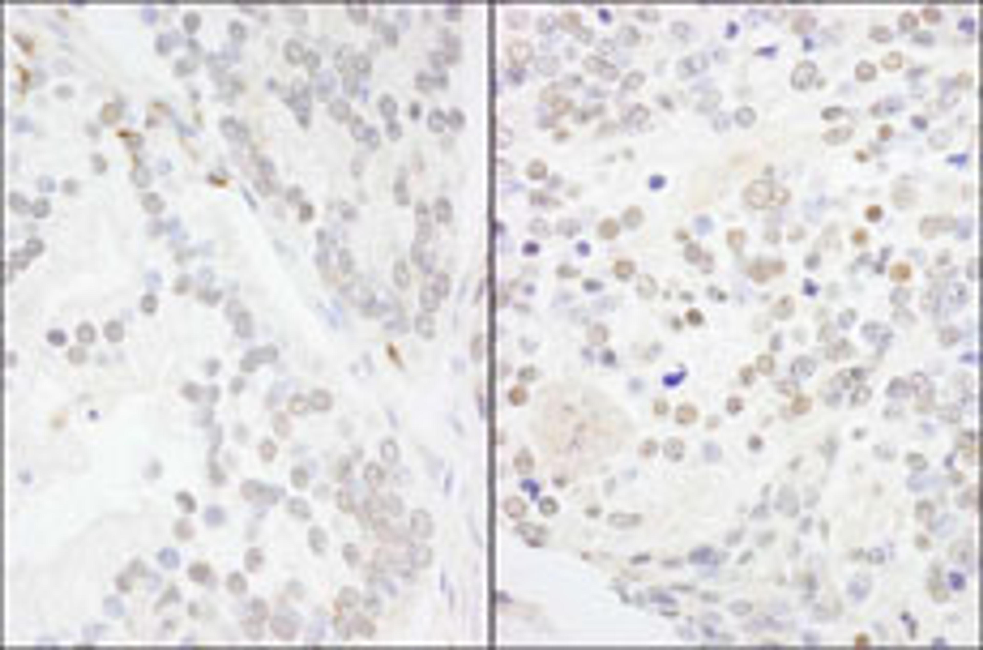 Detection of human and mouse ANKS3 by immunohistochemistry.