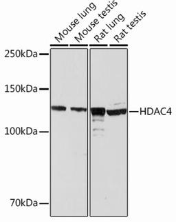 Western blot - HDAC4 Rabbit mAb (A13510)