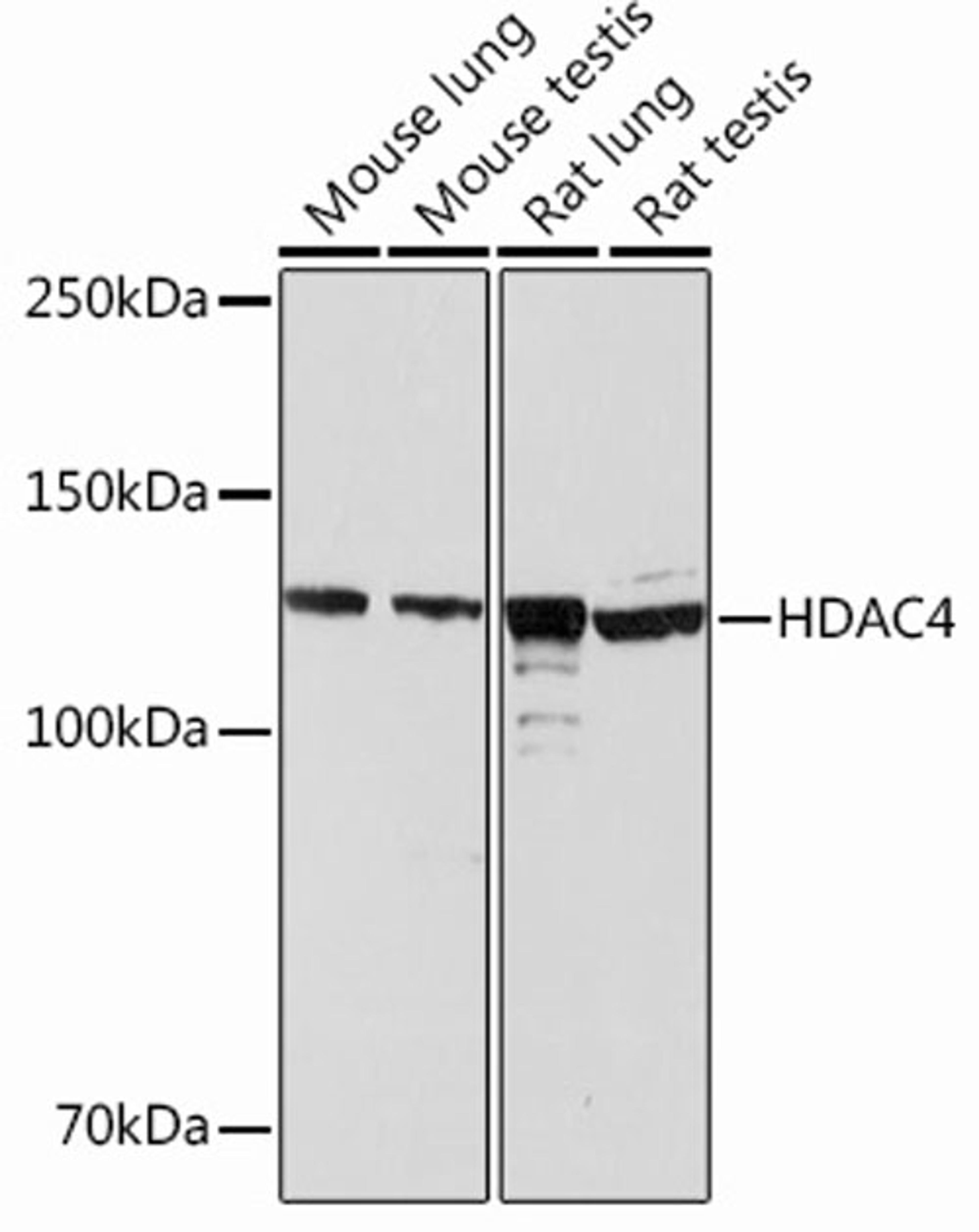 Western blot - HDAC4 Rabbit mAb (A13510)