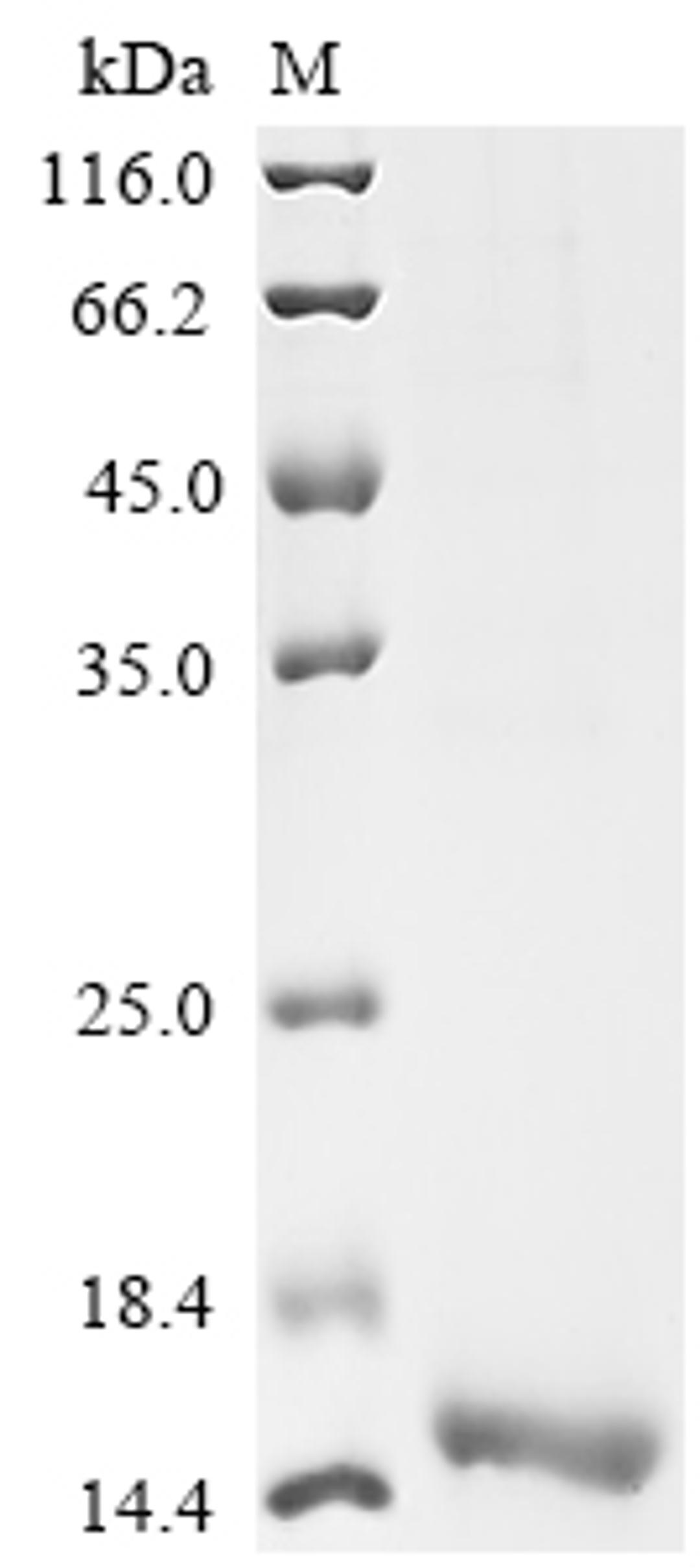 (Tris-Glycine gel) Discontinuous SDS-PAGE (reduced) with 5% enrichment gel and 15% separation gel.