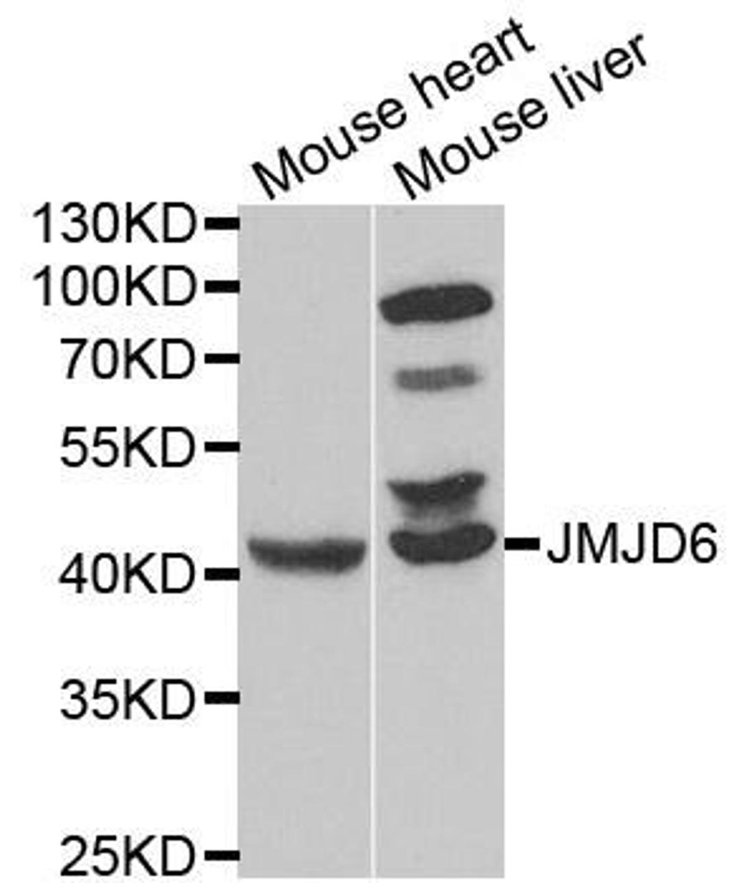 Western blot analysis of extracts of various cell lines using JMJD6 antibody