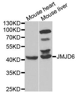 Western blot analysis of extracts of various cell lines using JMJD6 antibody