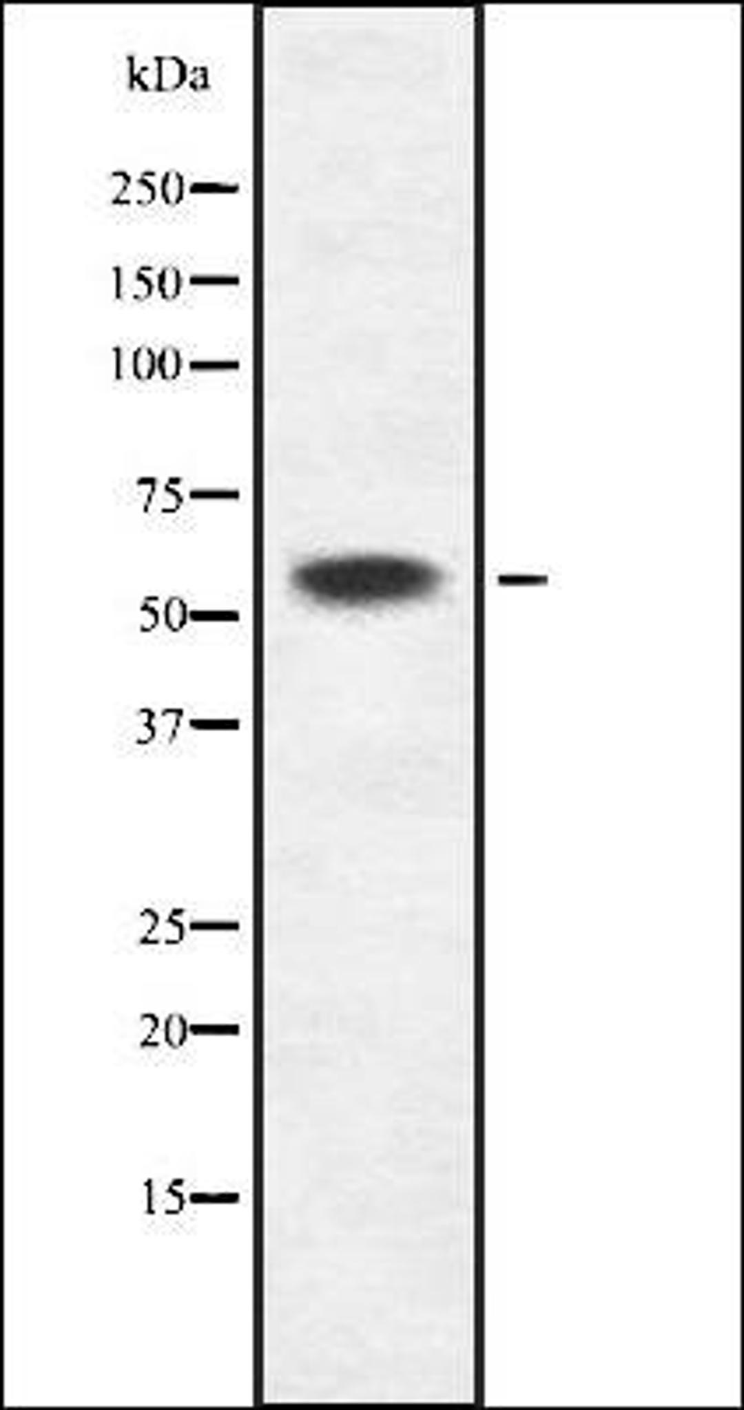 Western blot analysis of HEK293 cells using K2C6B/C antibody