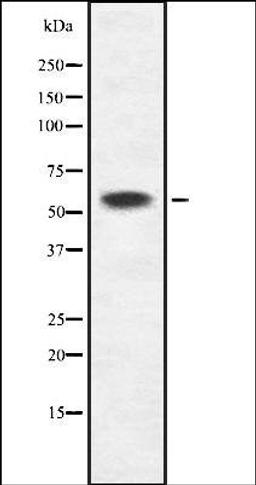 Western blot analysis of HEK293 cells using K2C6B/C antibody