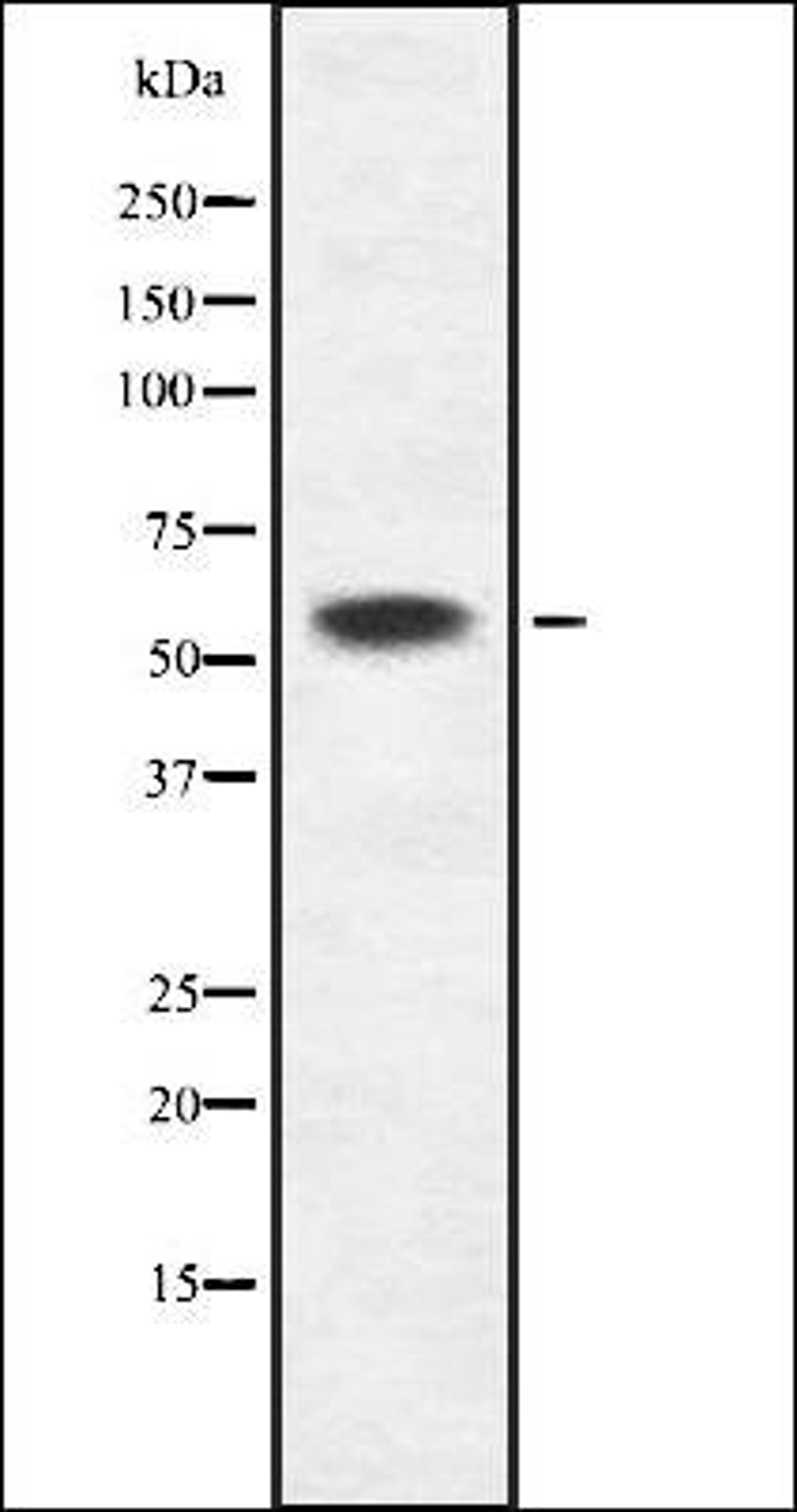 Western blot analysis of HEK293 cells using K2C6B/C antibody