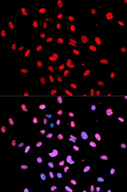 Immunofluorescence - Phospho-Btk-Y223 antibody (AP0100)