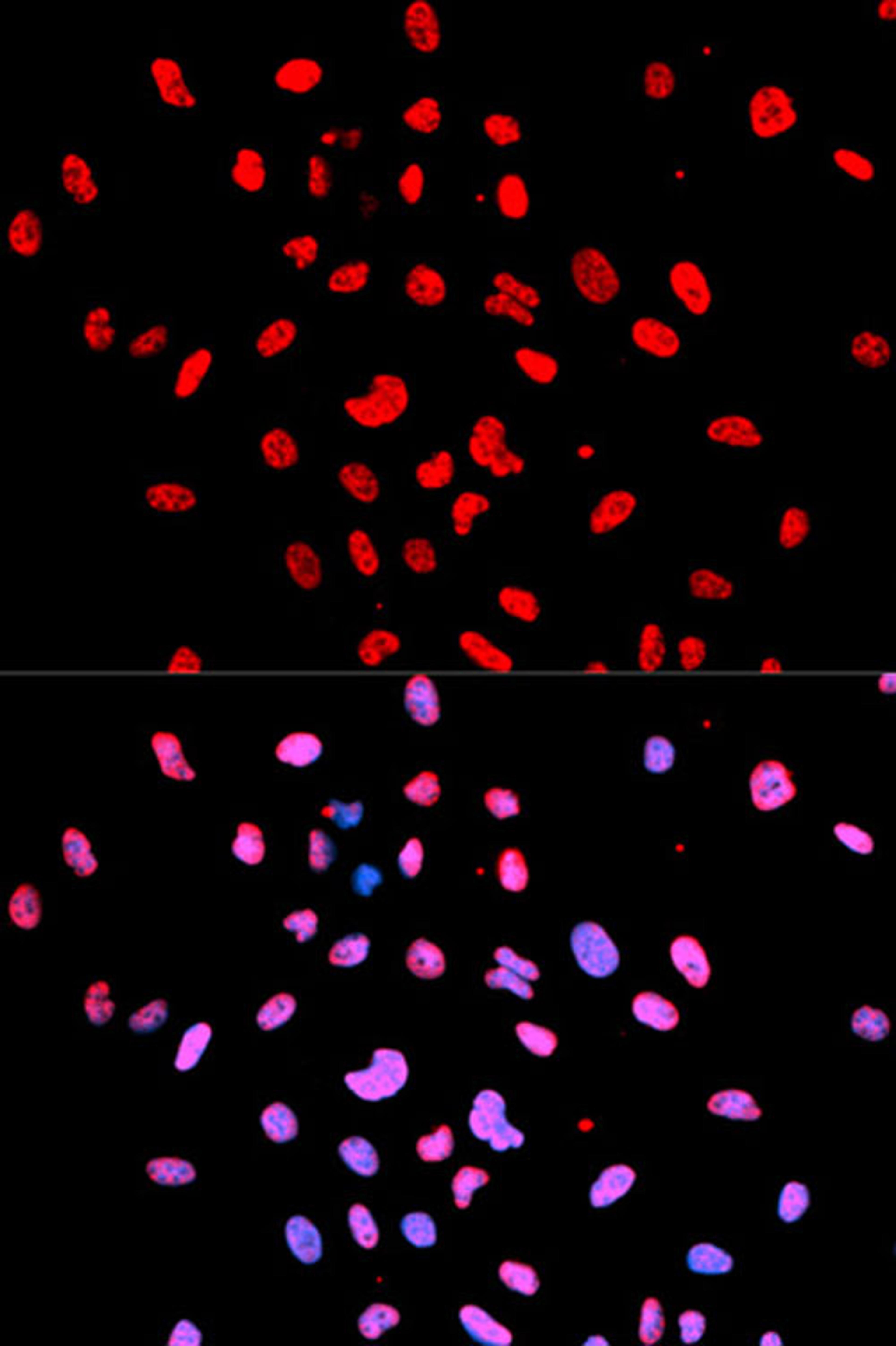 Immunofluorescence - Phospho-Btk-Y223 antibody (AP0100)