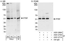 Detection of human and mouse PTRF by western blot (h&m) and immunoprecipitation (h).