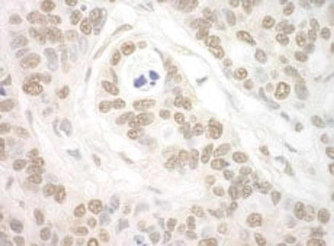 Detection of human Importin 7 by immunohistochemistry.