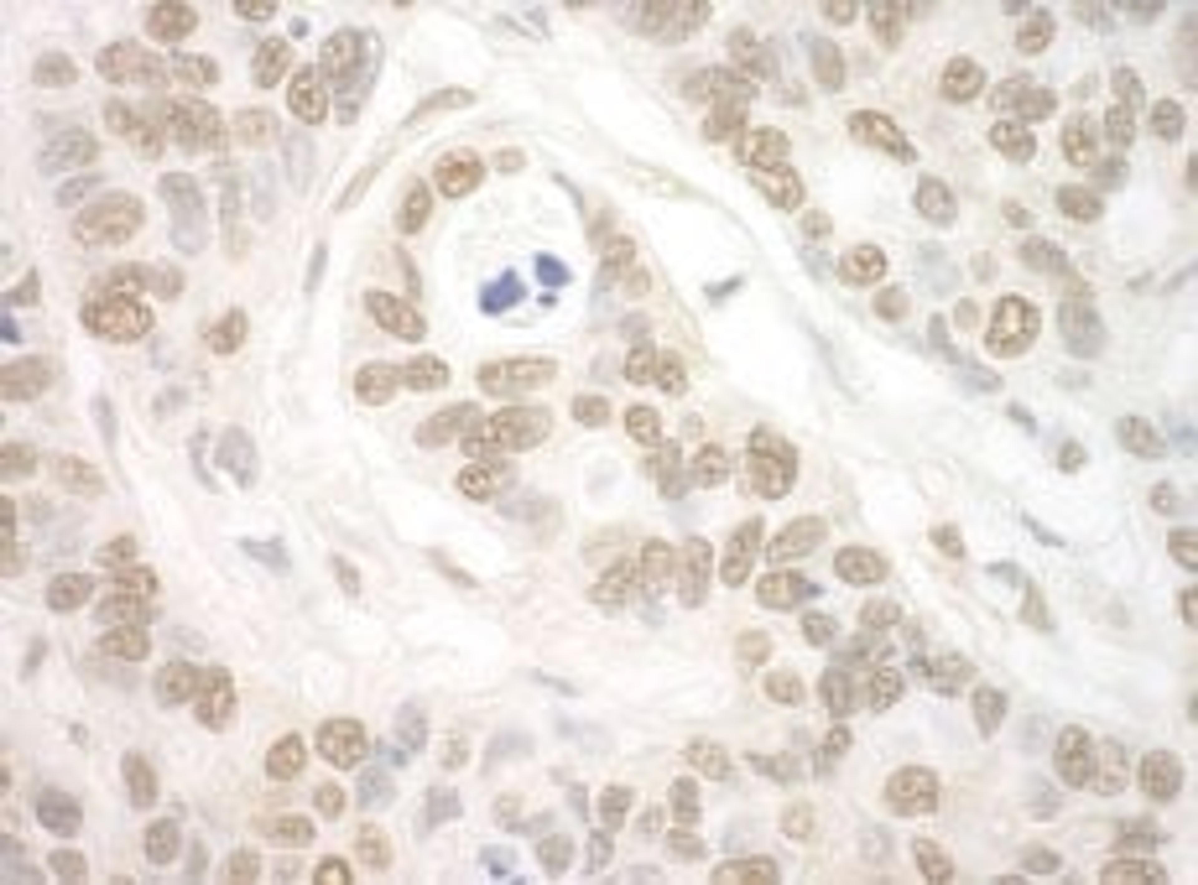 Detection of human Importin 7 by immunohistochemistry.