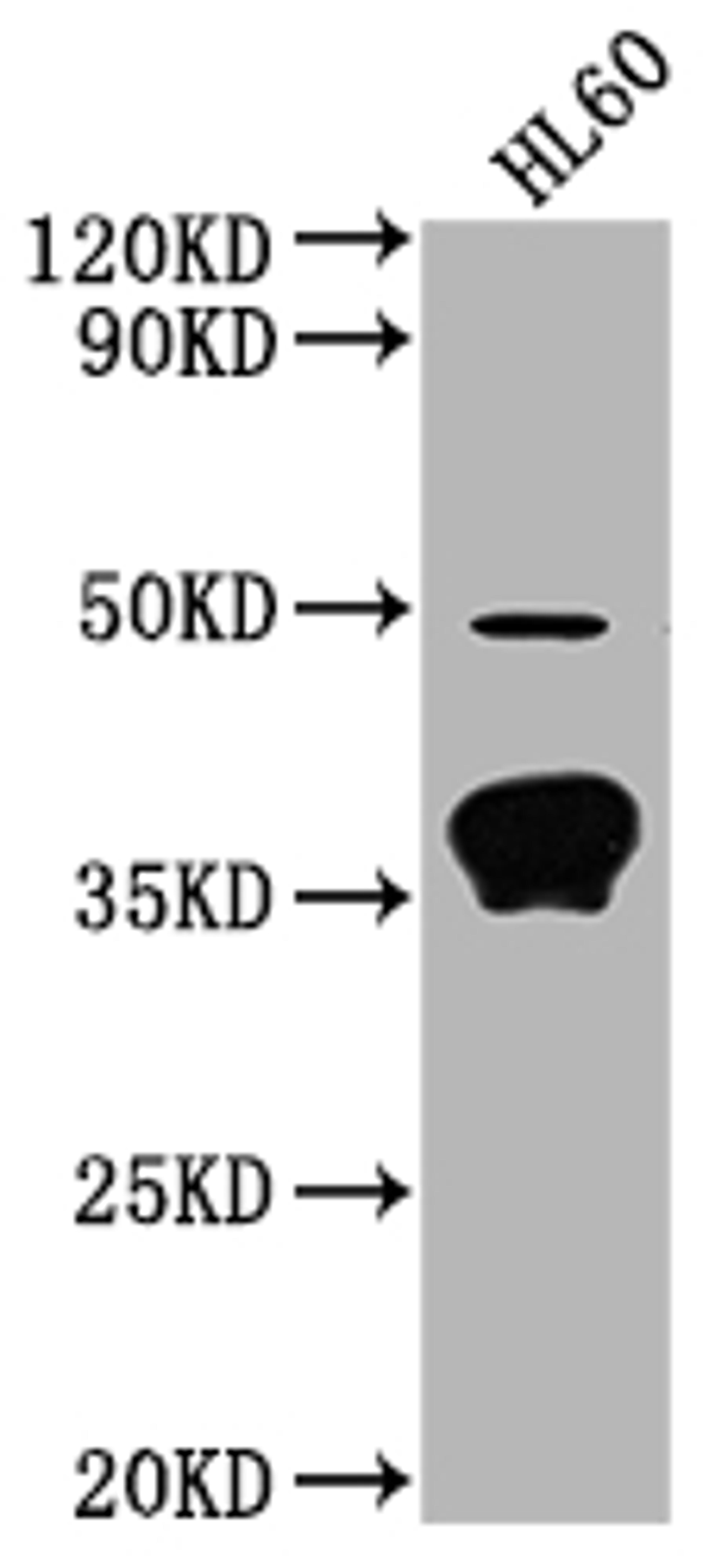 Western Blot. Positive WB detected in: HL60 whole cell lysate. All lanes: OR10P1 antibody at 1:2000. Secondary. Goat polyclonal to rabbit IgG at 1/50000 dilution. Predicted band size: 35 kDa. Observed band size: 35 kDa. 