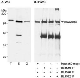 Detection of human KIAA0082 by western blot and immunoprecipitation.