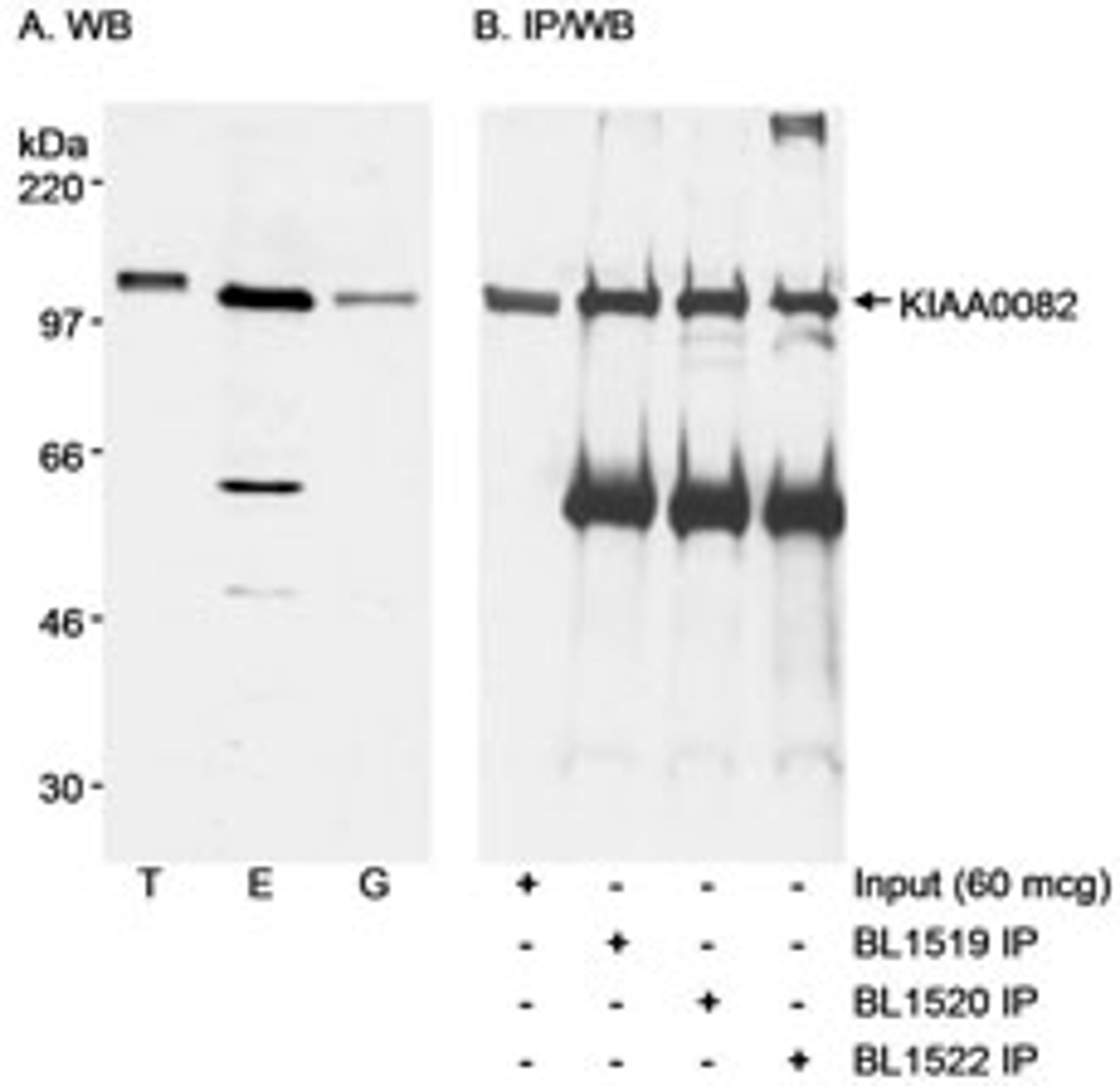 Detection of human KIAA0082 by western blot and immunoprecipitation.