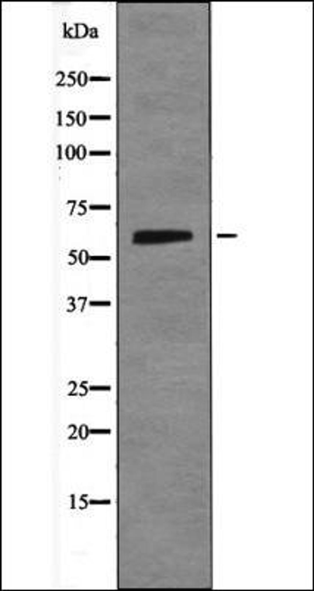 Western blot analysis of 293 whole cell lysates using Smad1 -Phospho-Ser214- antibody