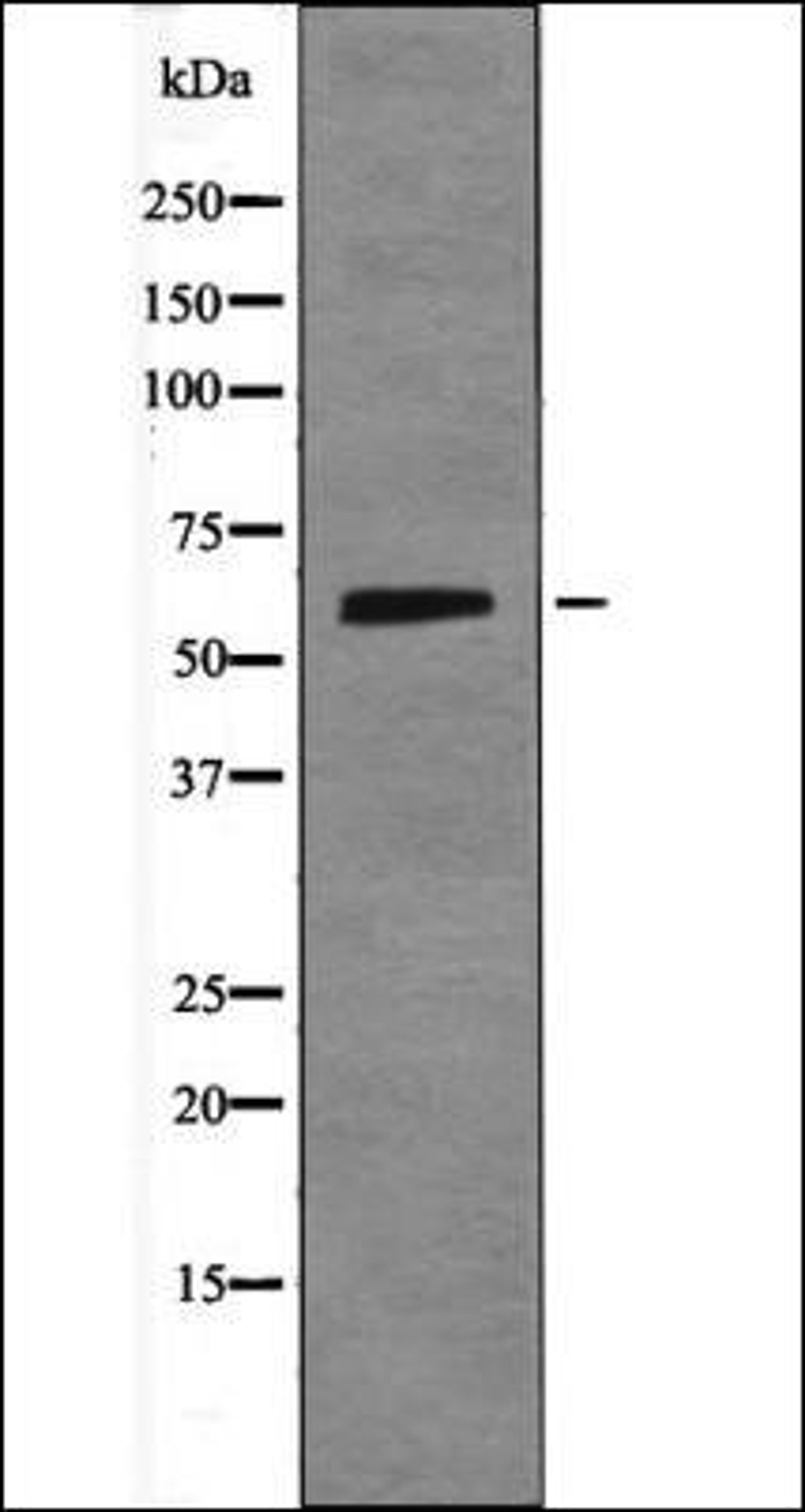 Western blot analysis of 293 whole cell lysates using Smad1 -Phospho-Ser214- antibody