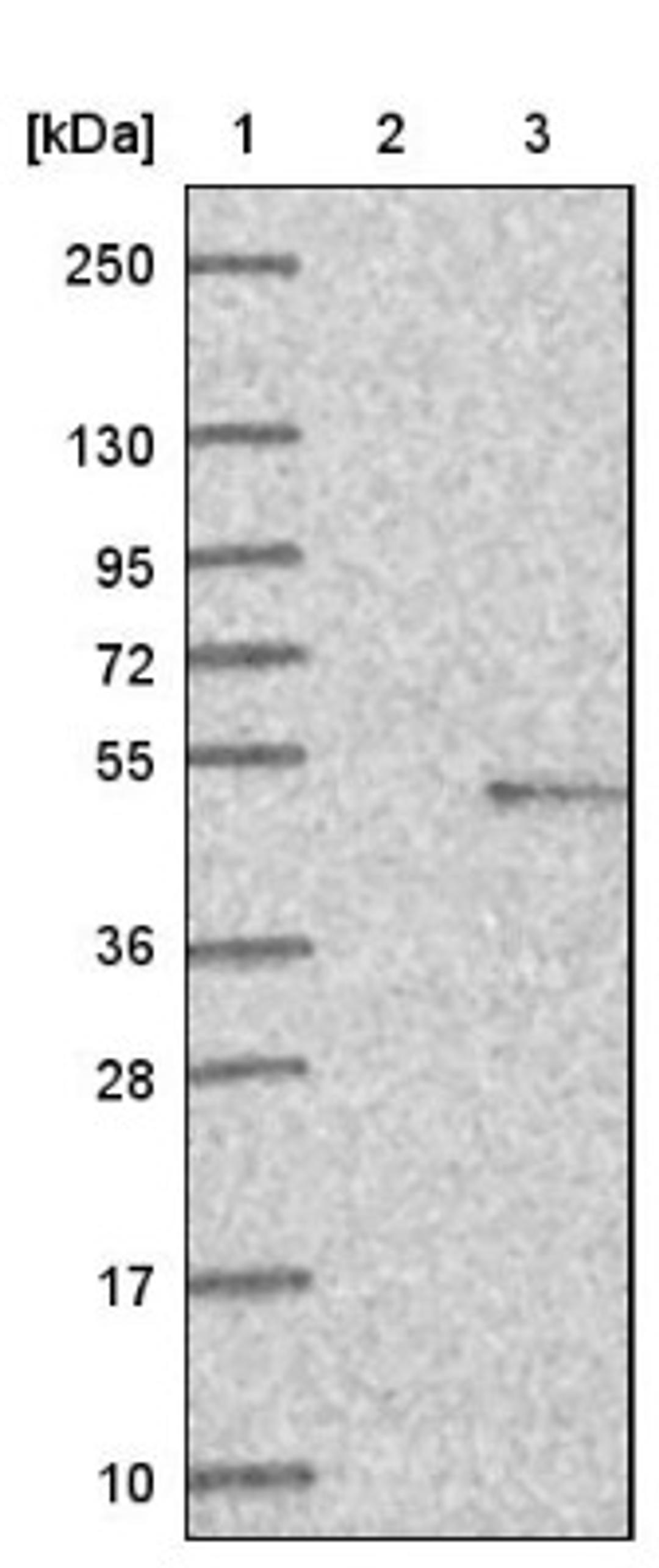 Western Blot: FADS1 Antibody [NBP1-84312] - Lane 1: Marker [kDa] 250, 130, 95, 72, 55, 36, 28, 17, 10<br/>Lane 2: Negative control (vector only transfected HEK293T lysate)<br/>Lane 3: Over-expression lysate (Co-expressed with a C-terminal myc-DDK tag (~3.1 kDa) in mammalian HEK293T cells, LY402257)