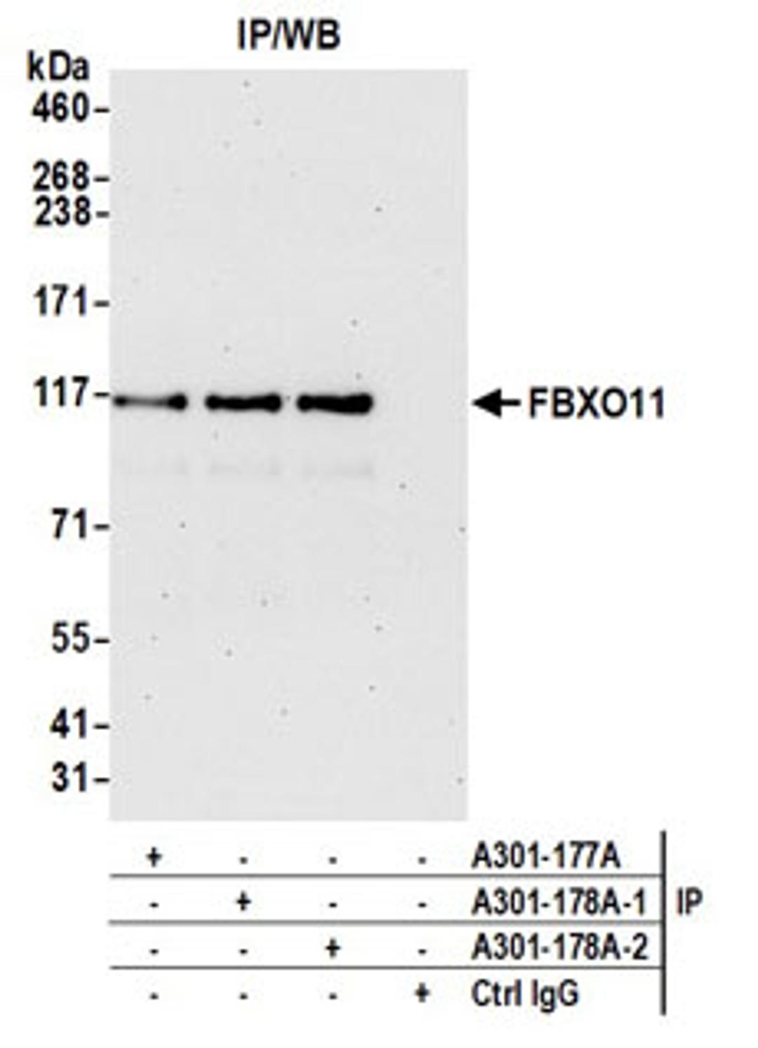 Detection of human FBXO11 by western blot of immunoprecipitates.