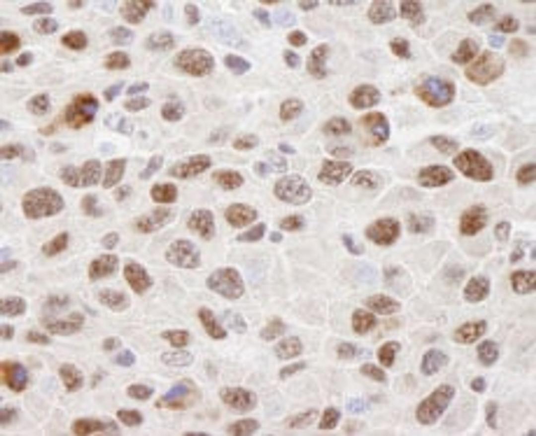 Detection of mouse hnRNP-U by immunohistochemistry.